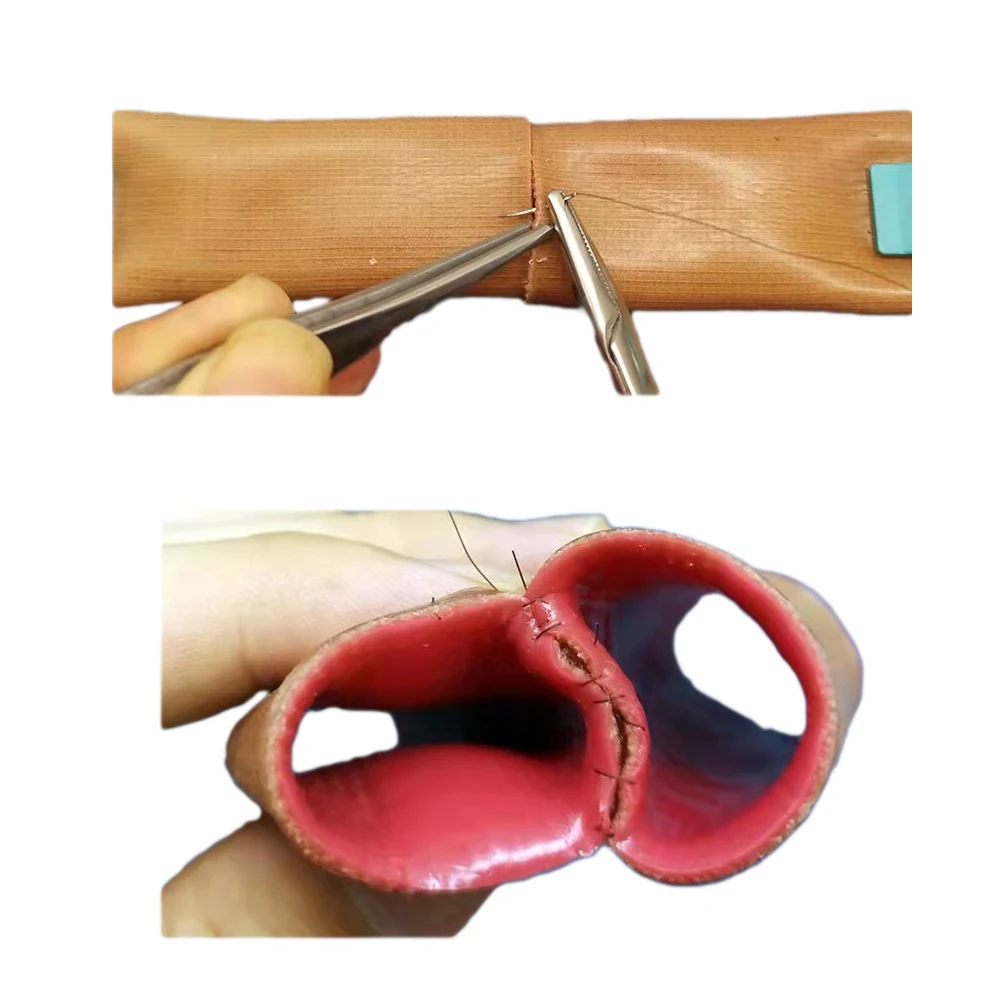 Intestinal Anastomosis Simulator,Double Layer Bowel Model,Surgical Suturing Laparoscopic Teaching