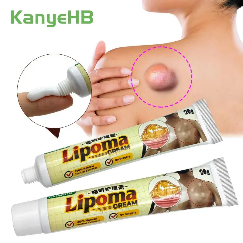 

2Pcs Anti-Swelling Lipoma Removal Cream Herbal Lymphatic Drainage Detox Treatment Breast Lymph Nodes Subcutaneous Lumps A1735