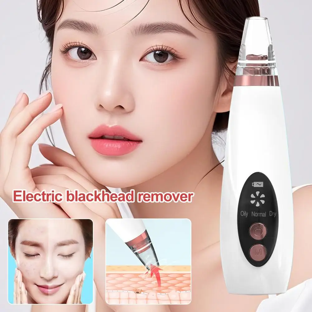Facial Pore Comedondrukker USB Oplaadbare Mee-eter Zuigkit Met 6 soorten zuigkop Pore Cleaning Care Tool