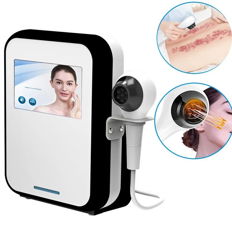 

Home Use Eye Bags Remover Wrinkle Eraser Facial Radio Frequency Tightening RF Lifting RF Vacuum Machine