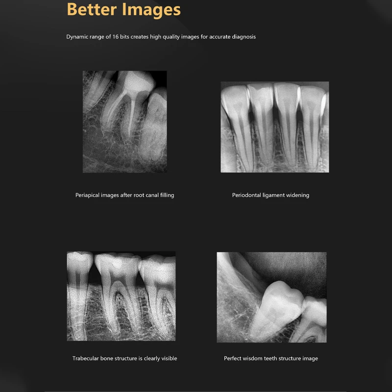 Radiowizograf stomatologiczny Liczenie fotonów Wewnątrzustny czujnik rentgenowski System obrazowania HD Narzędzie stomatologiczne z pozycjonerem