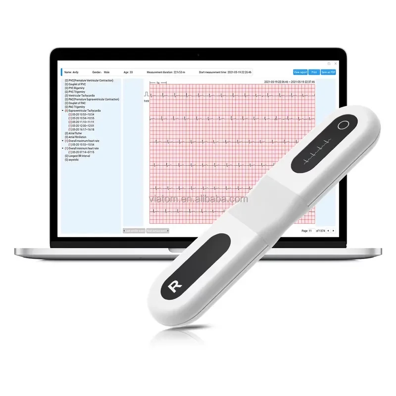 Modern Medical Wellue EPatch-T Portable Wireless Single-Lead Holter with AI- Analysis for Continuous Heart
