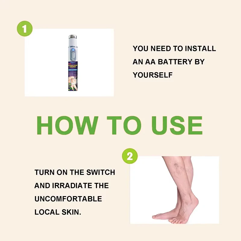 레이저 치료 다리 복구 펜, 최고의 선택은 페이스트와 펜입니다