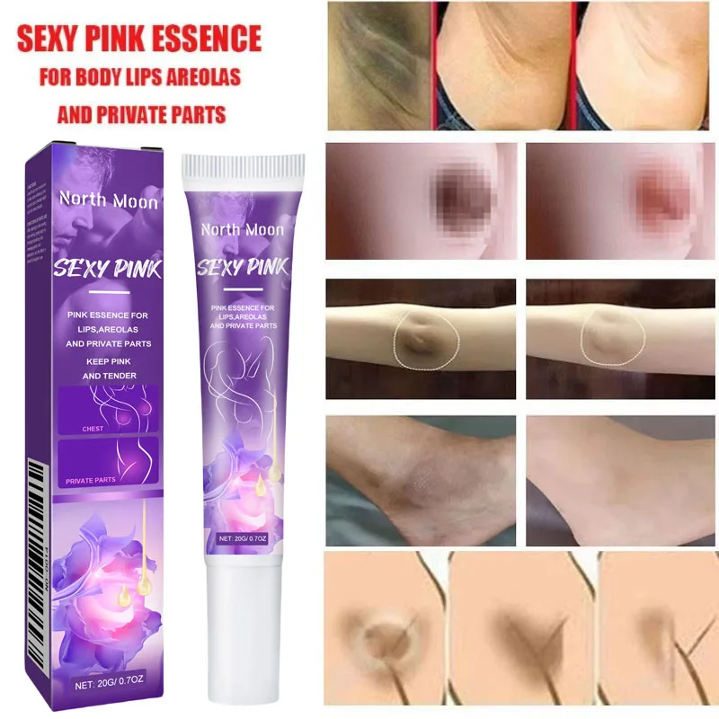 Crema sbiancante per il corpo per la pelle scura Area intima essenza rosa dulness illumina la pelle sbiancante bellezza salute per Dropshipping 20g