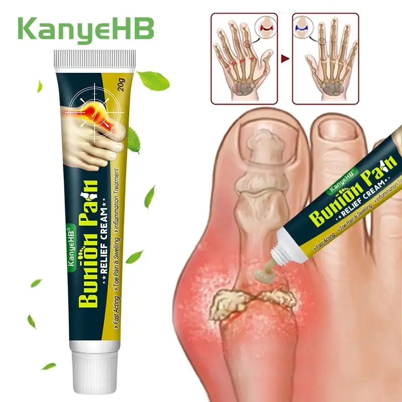 

1Pcs Bunion Gout Treatment Cream Relieve Joint Pain Treat Arthritis Limb Stiffness Toe Valgus Corrector Body Care Ointment G049