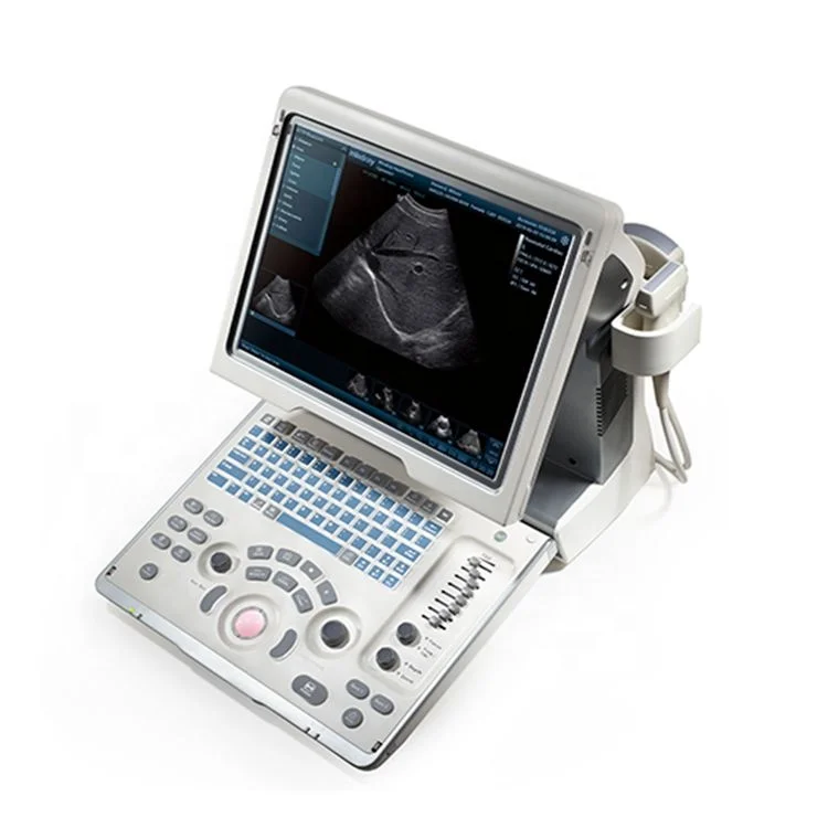 Mindray DP-50 Excellent Performance B&W Portable Ultrasound Machine