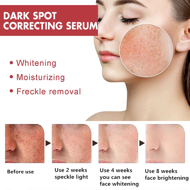 Niacinamide Serum Dark Spot Correcting Moisturizing Brightening Fade Fine Lines Deep Cleaning Makeup Remover Korean Skin Care