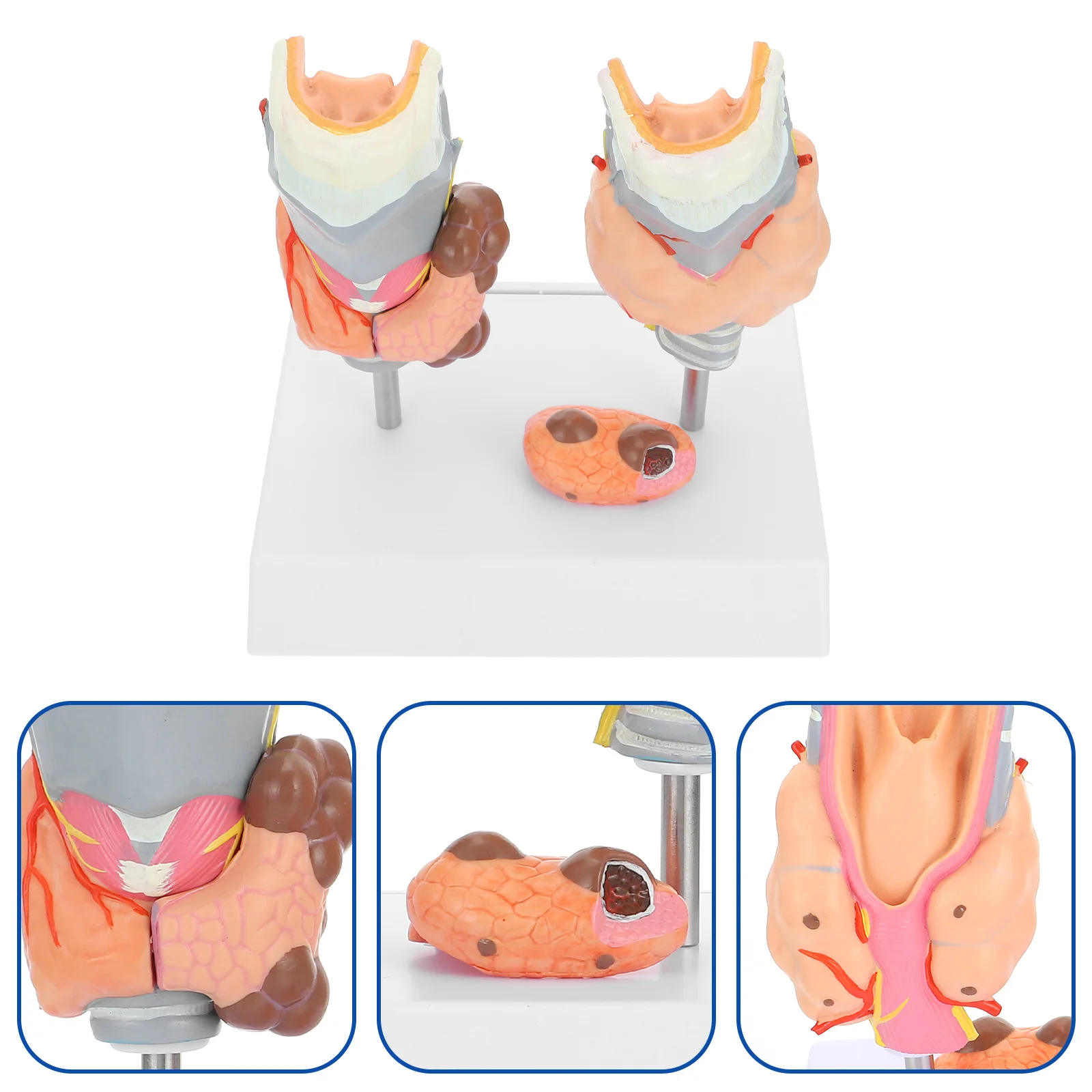 Model Patologi Tiroid Model Pengajaran Model Anatomi Model Sistem Endokrin Model Patologi Plastik Model Tiroid Plastik