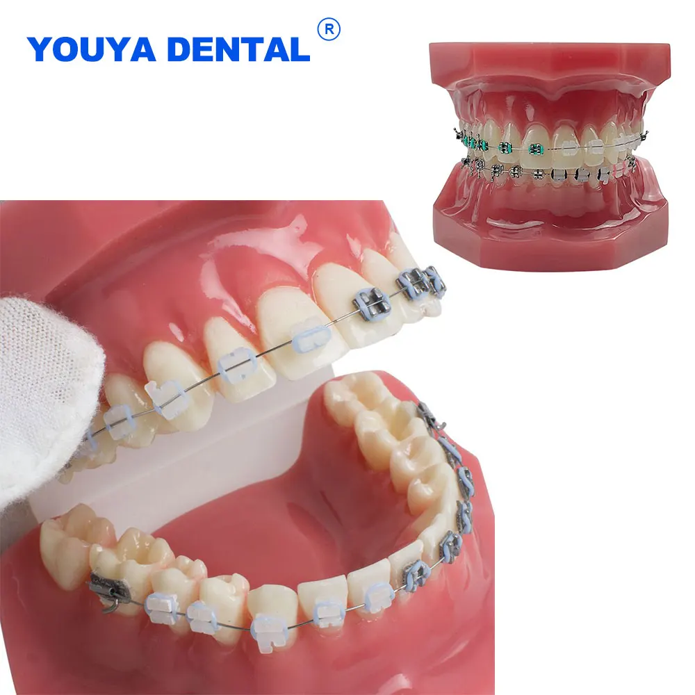 Stomatologiczne Model zębów ortodontyczne z aparatem ortodontycznym żywica dziąsła stomatologiczna materiał dentystyczny do studiowania edukacji