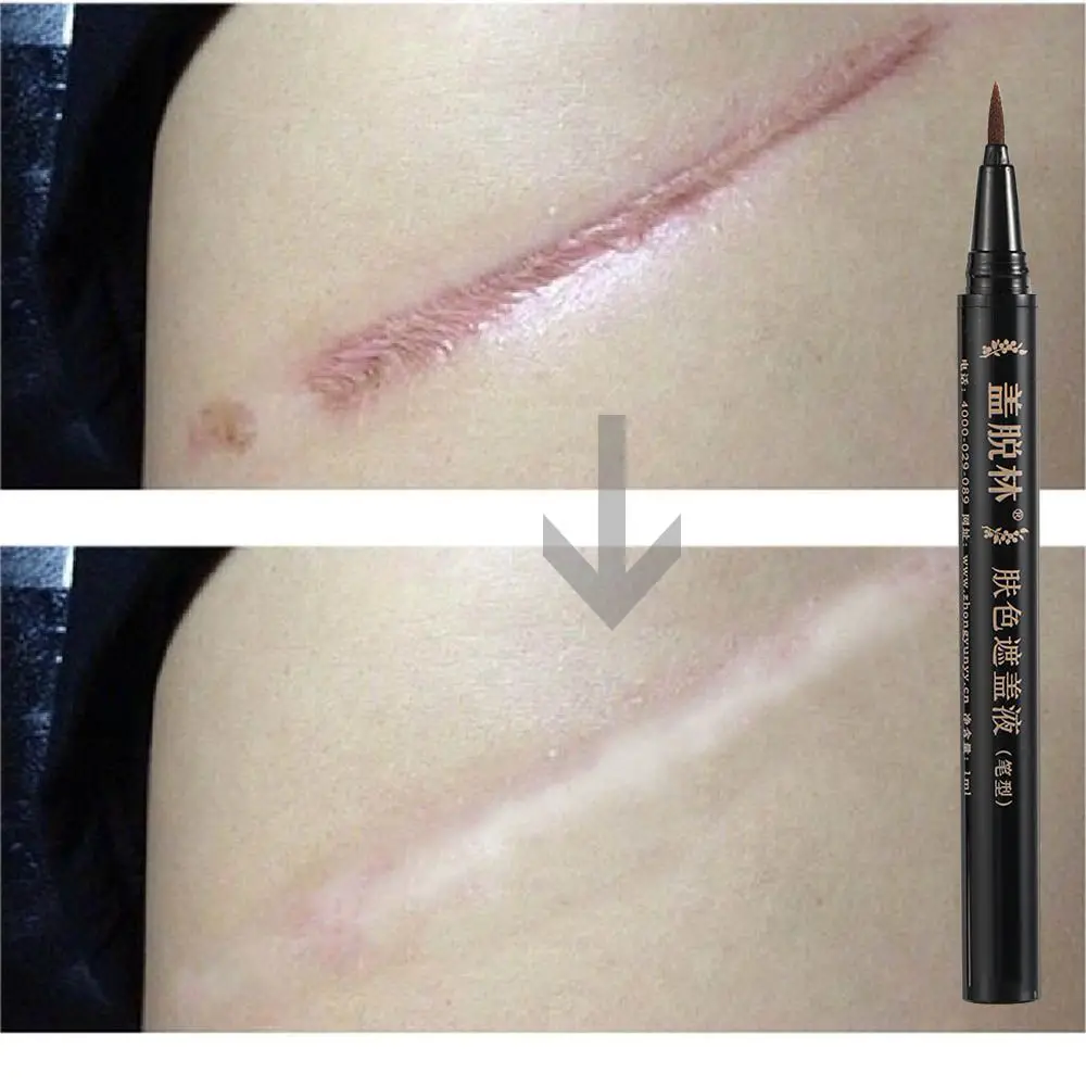 Marcos de nacimiento uso externo cicatrices de Vitiligo naturales cubierta pluma tatuaje corrector líquido manchas blancas corrector maquillaje de camuflaje