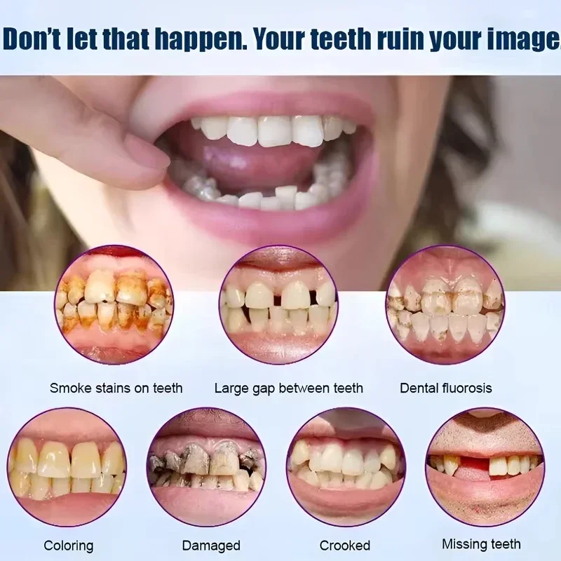 Slim Comfortable Custom Fit Dentures Boil to Shape Fits All Arch Sizes Reliable for Daily Meal Drink