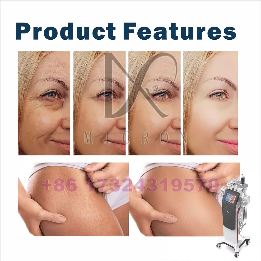 Schnelle schlanke 8 n1 80K Kavitation Lipo RF Ultraschall Kavitation Schlankheitsmaschine 80k professionell