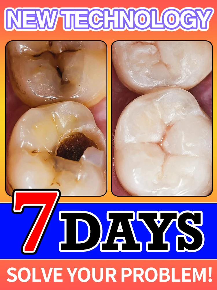 

Мгновенное решение для спасения полости: точное наполнение, попрощайте боль