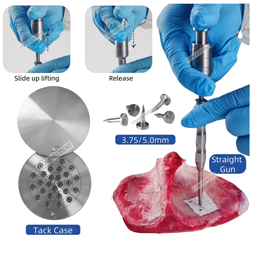 

Dental GBR Bone TAC Pins Case Mini Screw Titanium Guided Straight Head Auto Tacker Implant Instruments