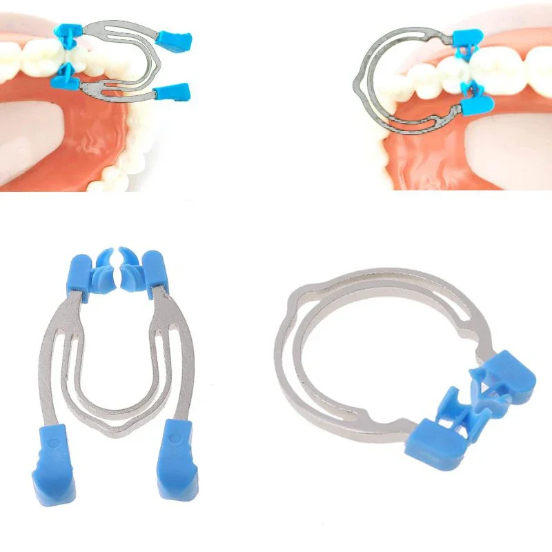 Dental Matrix Metal Spring Clip Contoured Matrix Ring for Teeth Replacement Clinic Lab Dental Tools