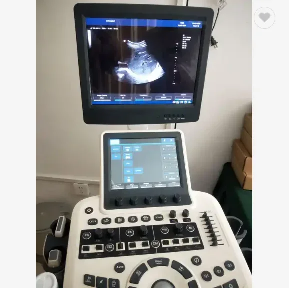 newest Zonecare advanced 4d color doppler abdominal ultrasound machine with elasticity image