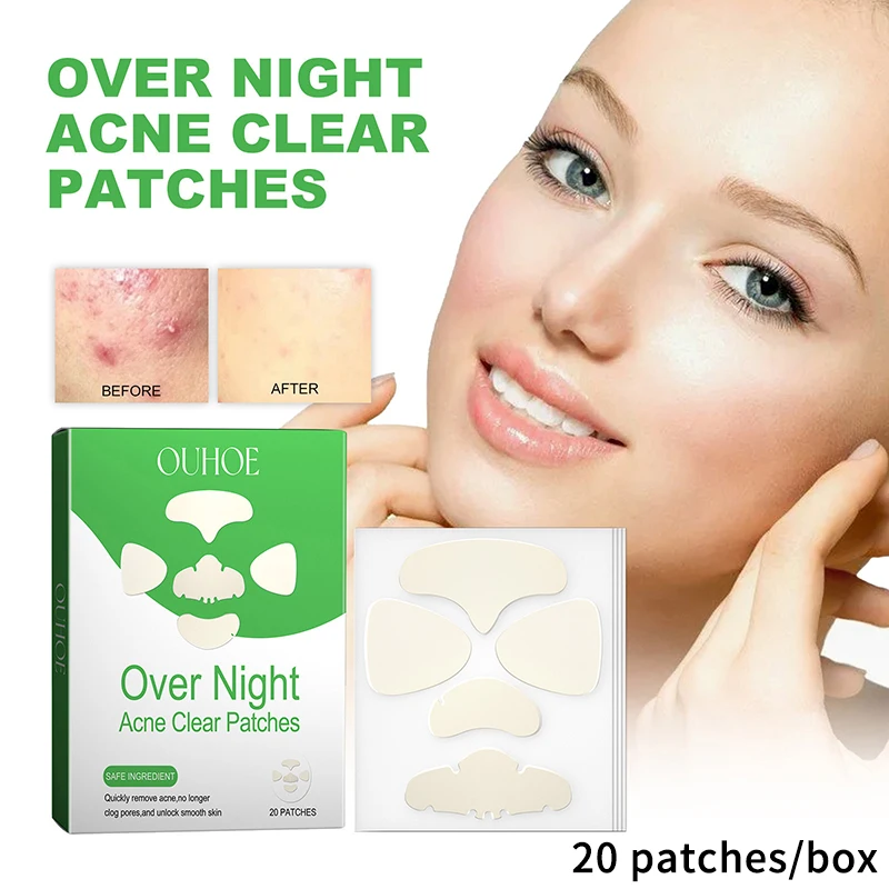 Invisible Acne Patches Nose Chin Forehead Cheek Pimples Removal Spots Marks Concealer Repairing Waterproof Hydrocolloid Stickers