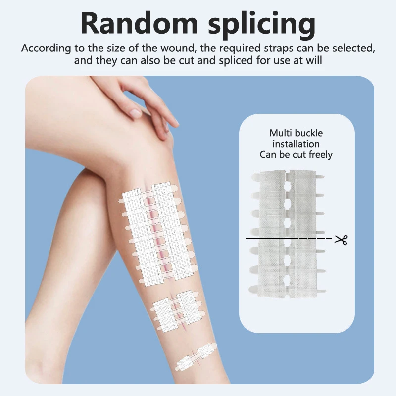 Vendajes para heridas con puntada con cremallera, cierres para heridas de emergencia, adhesivo sin costuras, cortable, sutura rápida, transpirable, indoloro, impermeable