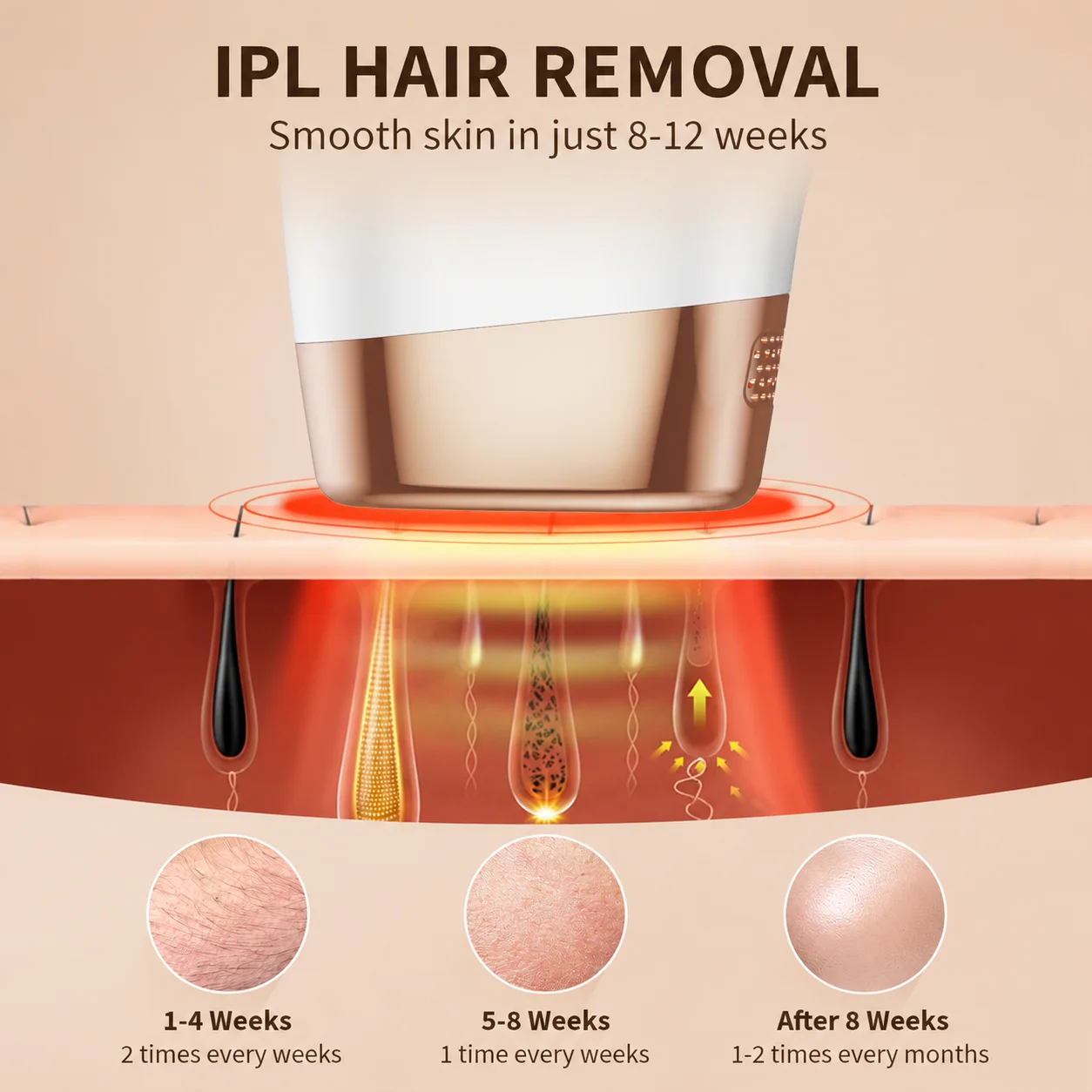 Thumbnail 2 - #34 IPL Devices Comparison Guide