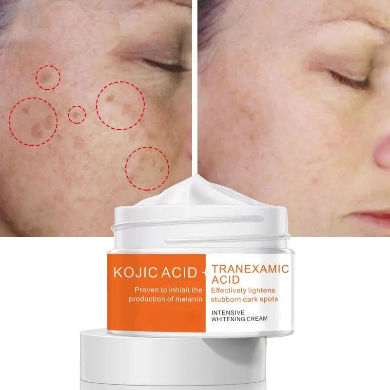 

Anti Freckle Pearl Skin Brightening Cream Remove Face Spot Brighten Skin Contain Herbal Serum Skin Care Face Essence