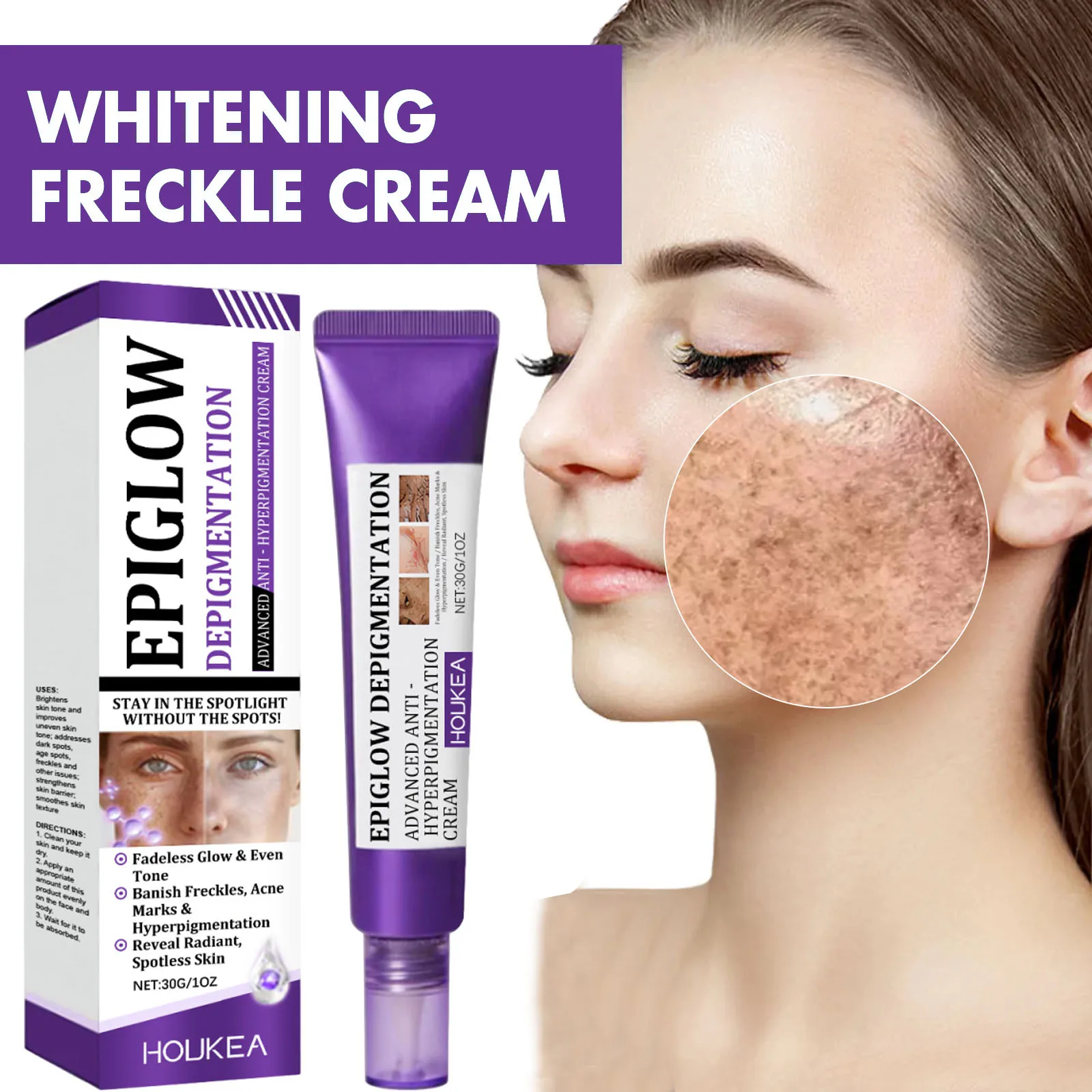Crema Blanqueadora para Pecas, Melasma y Manchas Oscuras, Producto para Eliminar la Pigmentación, Atenúa las Manchas de Melanina, Reparación Rápida, Ilumina, Cuidado de la Piel Coreano