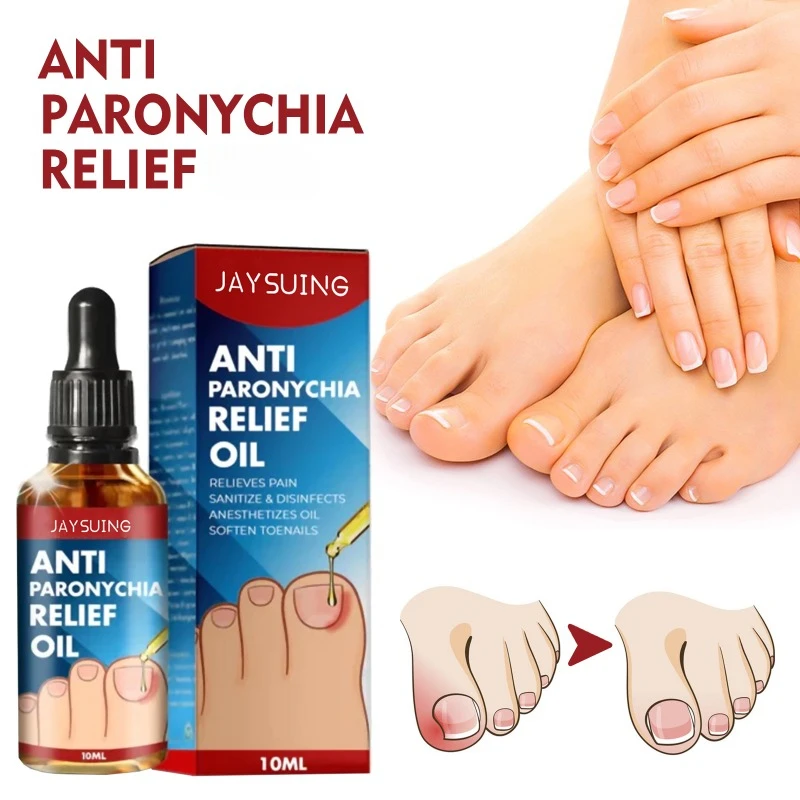 Anti-nail groove relief oil soft nail polish repair ingrown toenails thickening onychomycosis Treatment fungal Infection care