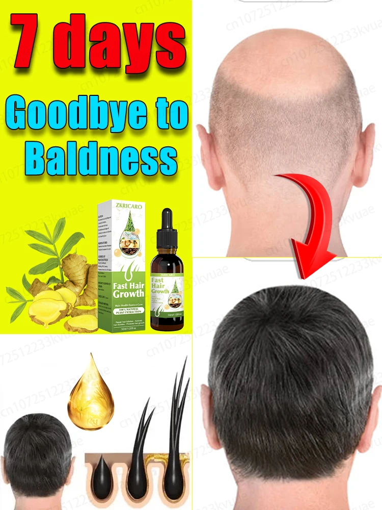 

Rapid hair growth essential oil to repair hair loss and baldness