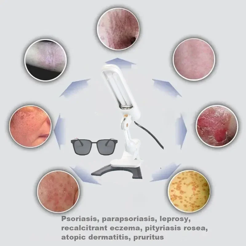 Thumbnail 3 - #31 Compare Light Therapy Lamps Before You Buy