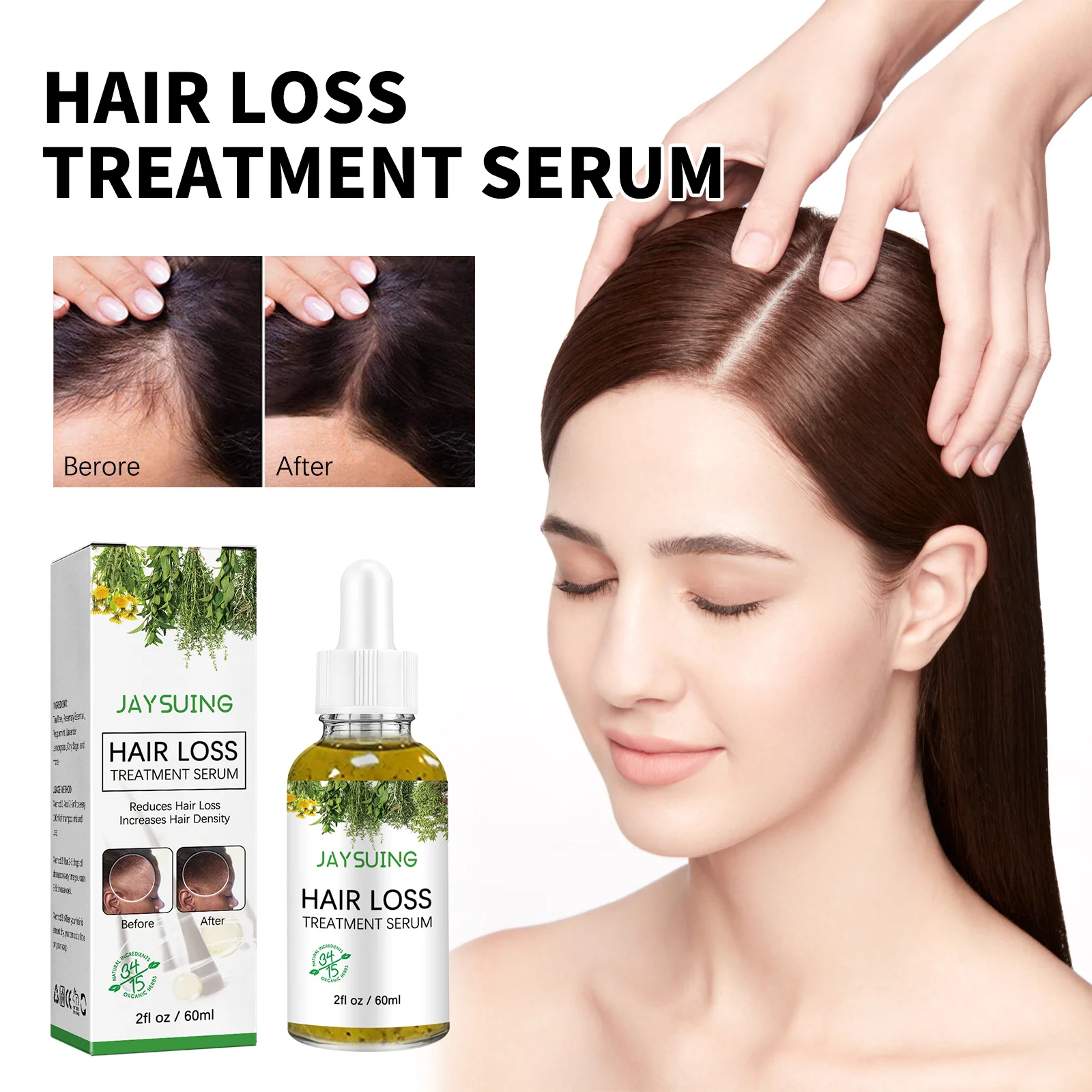 Hair Loss Treatment Shampoo Anti-itch Anti Dandruff Oil Control Hair Growth Serum Oil Scalp Root Thicker Fast Regrowth Essence