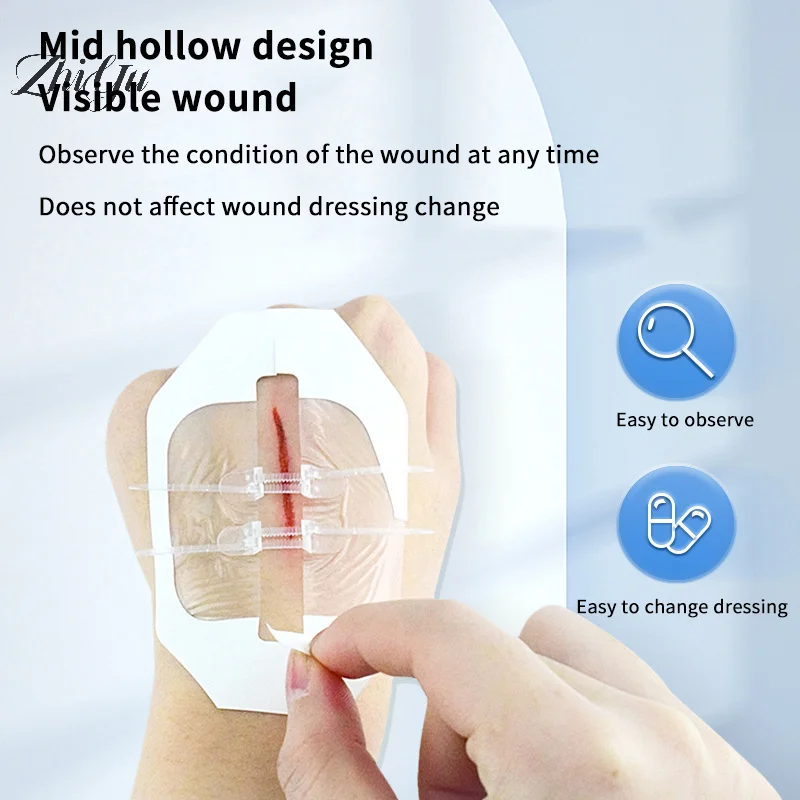 2 Pz/scatola Cerniera Cravatta Chiusura della Ferita Patch Cinghia Elastica Sutura Veloce Patch Emostatico Cura Della Pelle Disinfettare Cerotto All'aperto Portatile