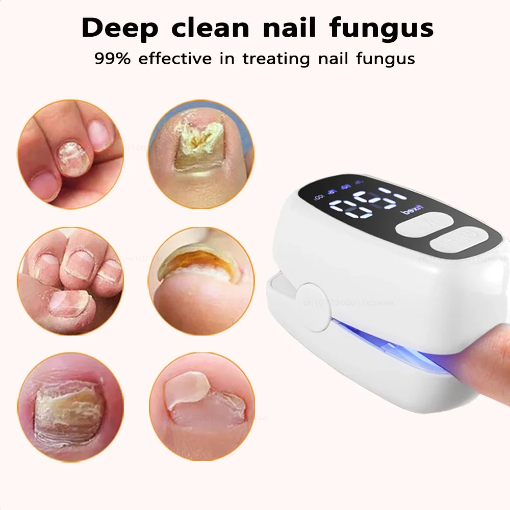 Dispositivo de hongos Lase r para uñas de los pies múltiples, onicomicosis, reparación de uñas, equipo antifúngico Lase r