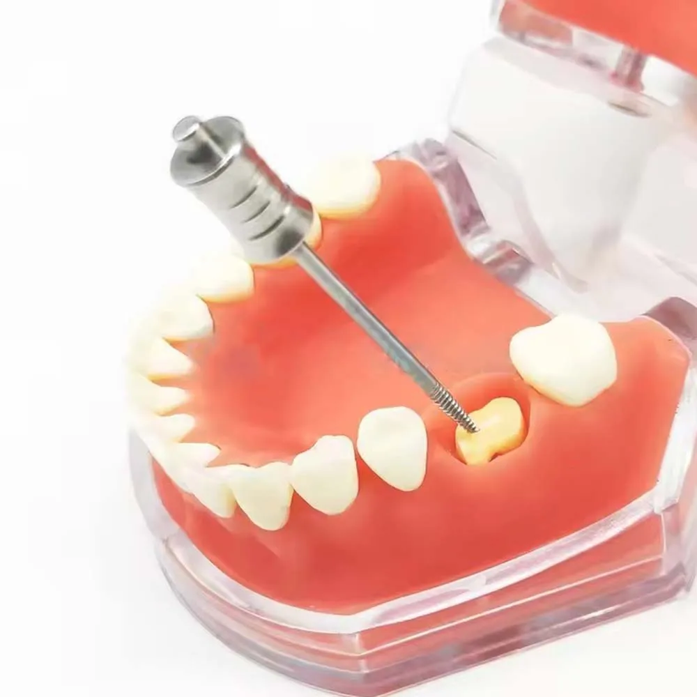 

1 шт. Стоматологический экстрактор для удаления обломков корней зубов, нержавеющая сталь, BHL33-FRO