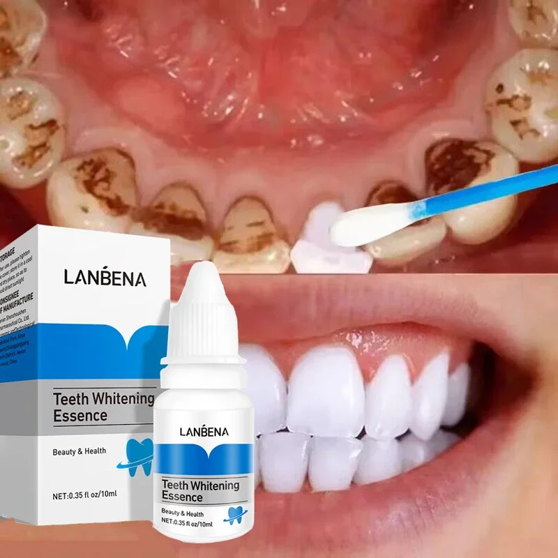 Esencia para blanquear los dientes, elimina las manchas de placa de caries dentales, suero, aliento fresco, higiene bucal, herramientas de limpieza Dental