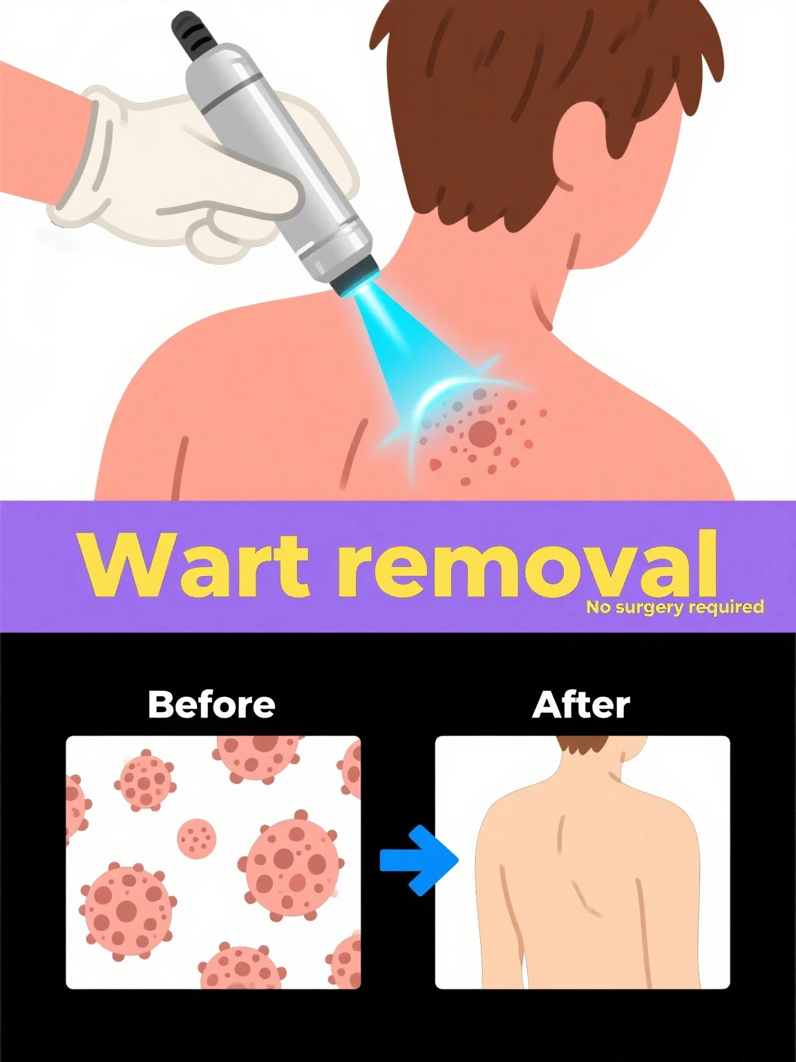 

Припадает естественно, не оставляет любую шрамы, безболезненно и бесследно.