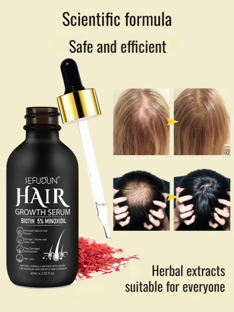 Siero a base di erbe antichair Fall Dense Hair Dry nutriente balsamo per il cuoio capelluto crescita dei capelli Mino Serum