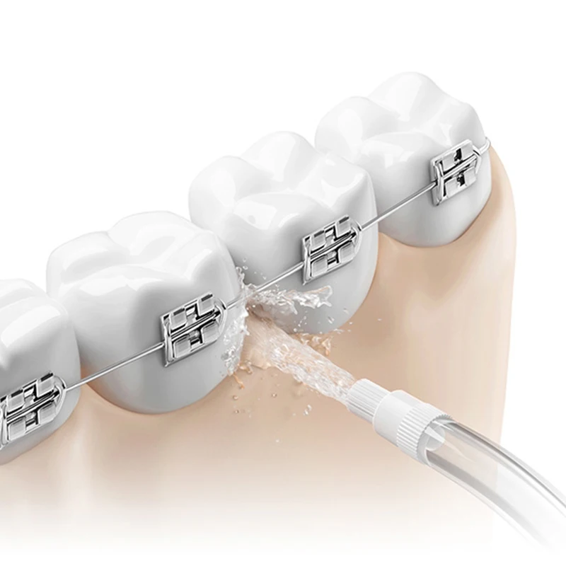 100% الأصلي Xiaomi Mijia القياسية تقويم الأسنان فوهة لري الفم استبدال ل MEO701 MEO702 MEO703 MEO704 MEO705