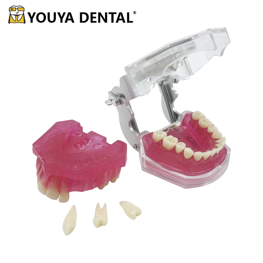 Standard Teeth Teaching Model Detachable 28 Tooth Extraction Model For Dental Student Practice Demonstration Module