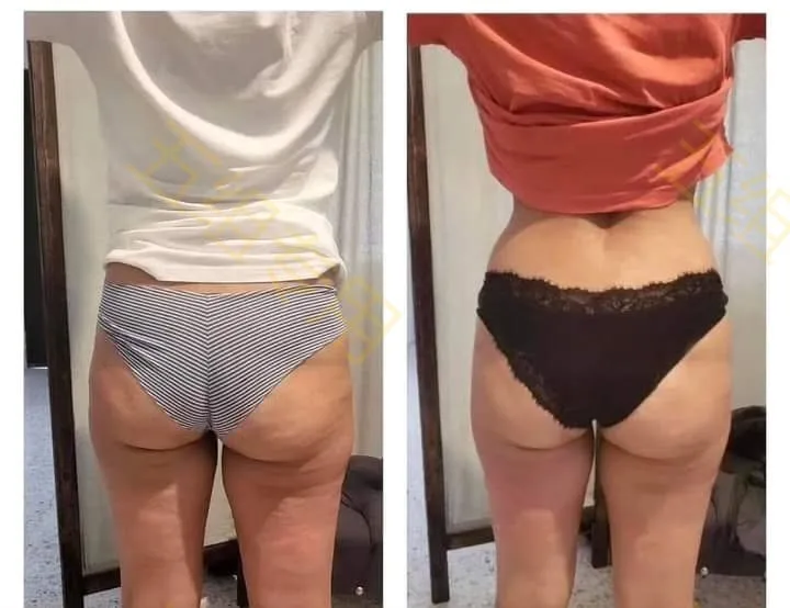 2025 جديد Myoslim neo HI-EMT مع تدليك الأسطوانة حرق الدهون تشكيل الجسم وبناء آلة العضلات الماس الأبيض