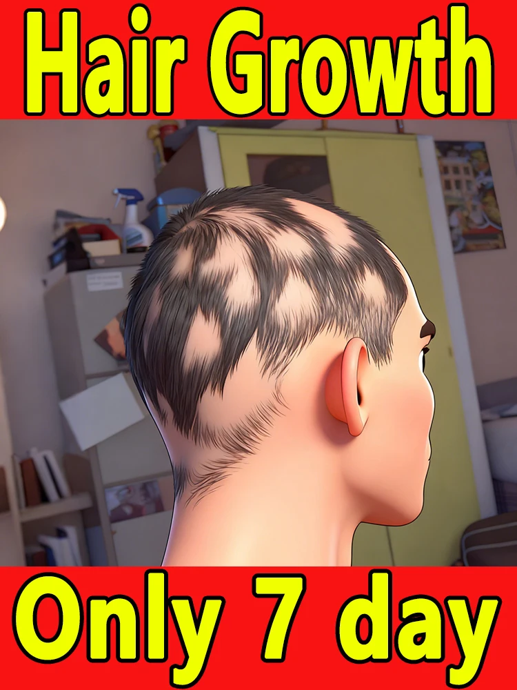 

Want to say goodbye to hair loss Our hair growth products can penetrate the scalp, promote hair growth, and help you regain you