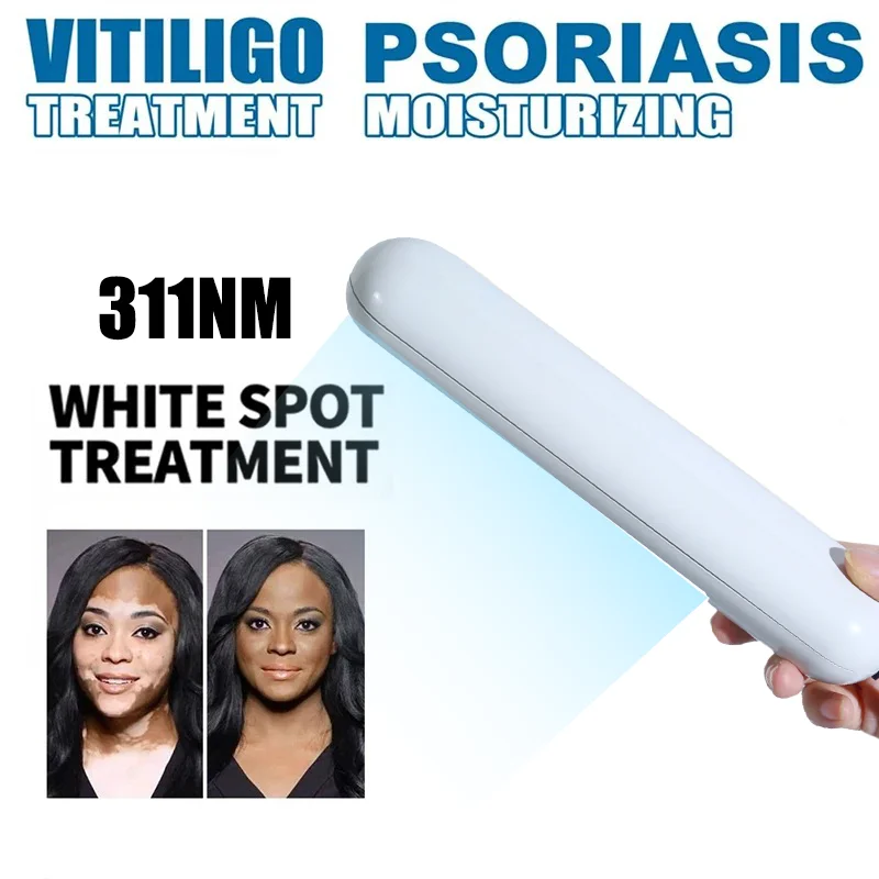 

UVB Ultraviolet Phototherapy Instrument Vitiligo Treatment UV Lamp Laser for Therapy Vitiligo Psoriasis Skin Disease