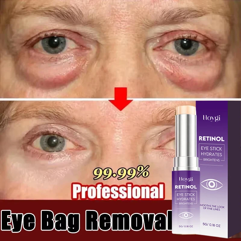 

Retinol Eye Cream Collagen Multibalm Stick Reduce Wrinkles Eye Bag Hyaluronic Acid Anti Dark Circle Puffiness Eye Care Products