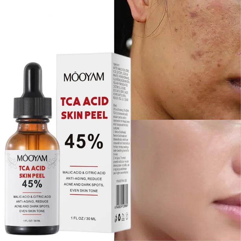 45% 50% Tca Aid Skin Peel Pore Minimizing Spots Remove Anti Wrinkle Skin Peeling Facial Serum