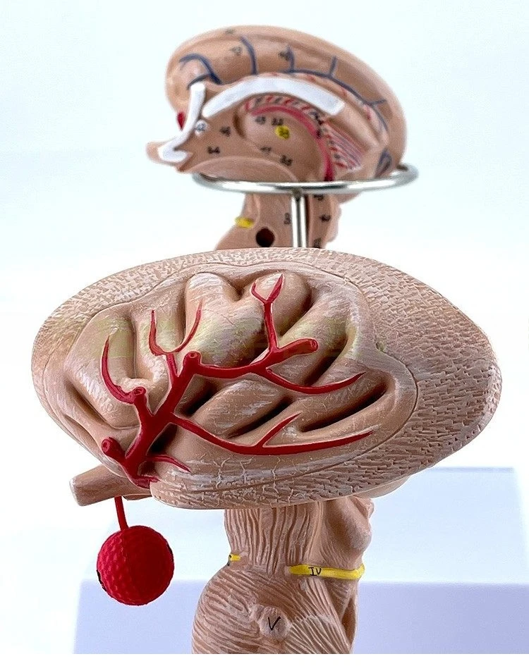 brainstem amplification model brainstem anatomical model