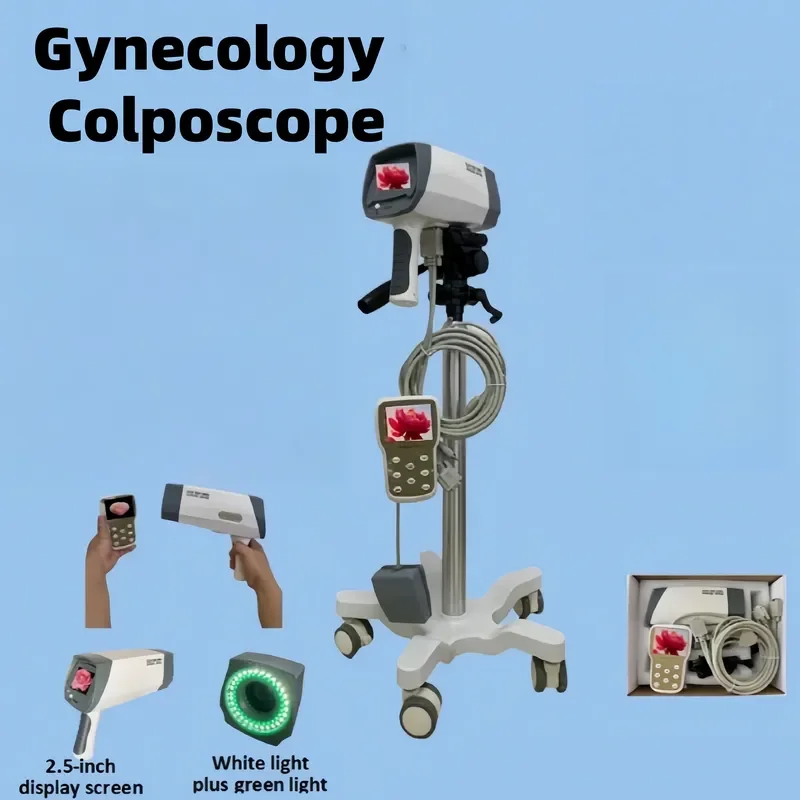 Professional Digital Colposcopy System – Portable Handheld Video with Software Workstation