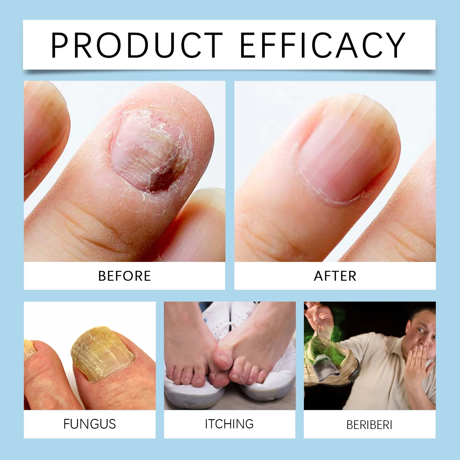 10ML OUHOE 균열 방지 매니큐어, 연약한 네일 표면을 밝게하고 영양을 공급, 에센스 오일 네일 케어