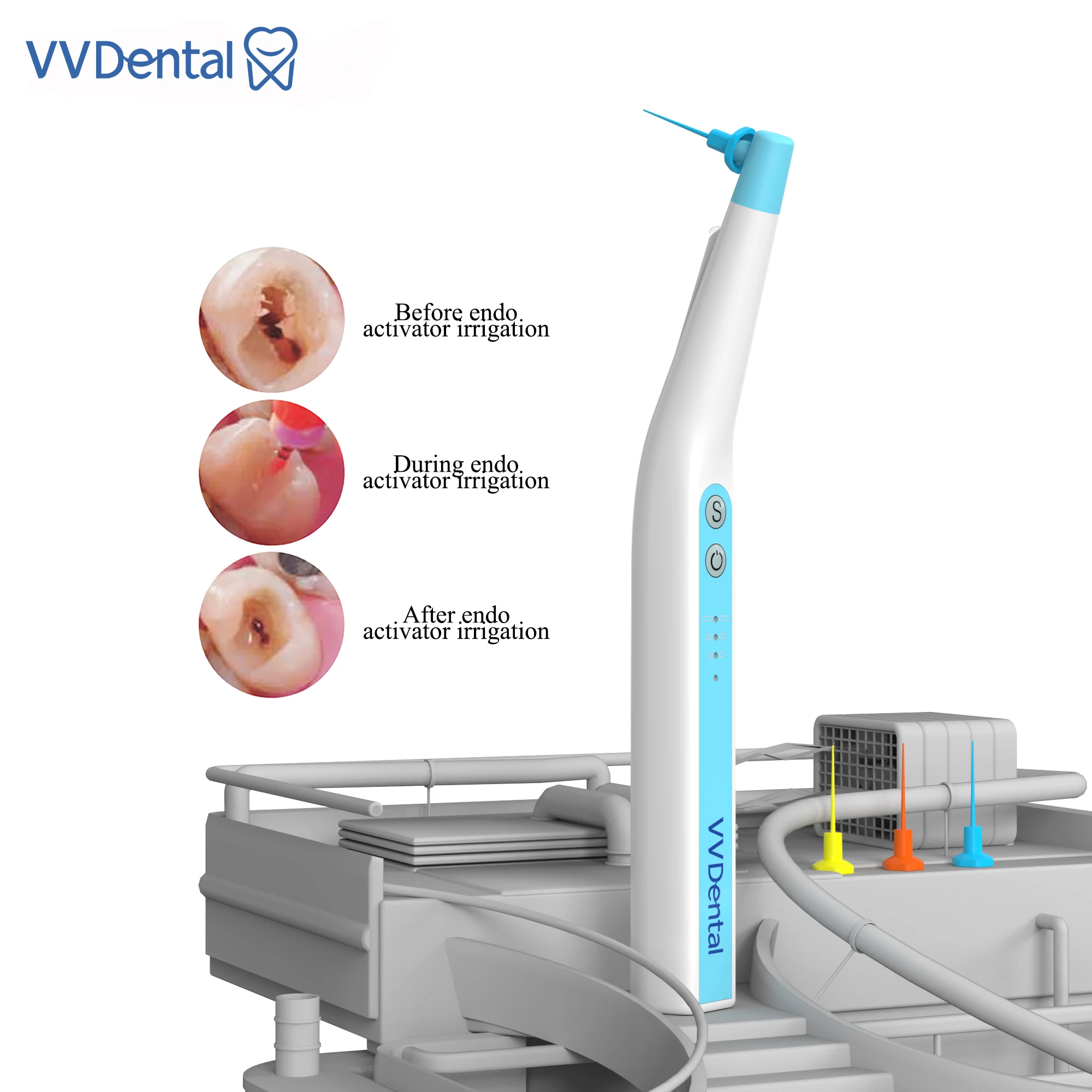 VVDental Dental Sonic Activator for Endo Root Canal with 60Pcs Activator Tips Dentistry Instrument Endo Cleaning Odontologia Son