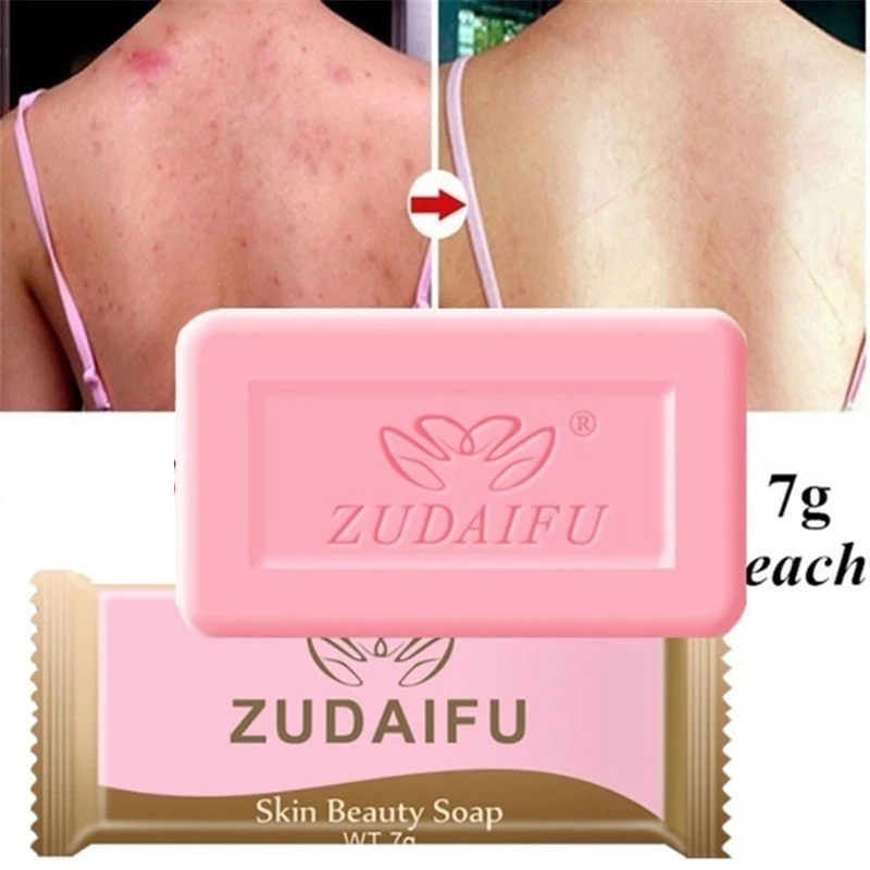 Sulfur Soap Anti-mites Anti-acne Body Cleansing Soap Skin Treatment Acne Psoriasis Seborrhea Eczema Anti Fungus Pink Color