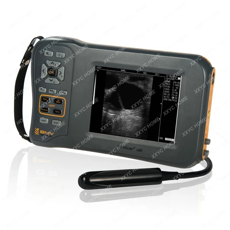 portable ultrasound veterinary bmv farmscan l60 pig cow sheep horse pregnancy scanner l60 veterinary ultrasound usg portable