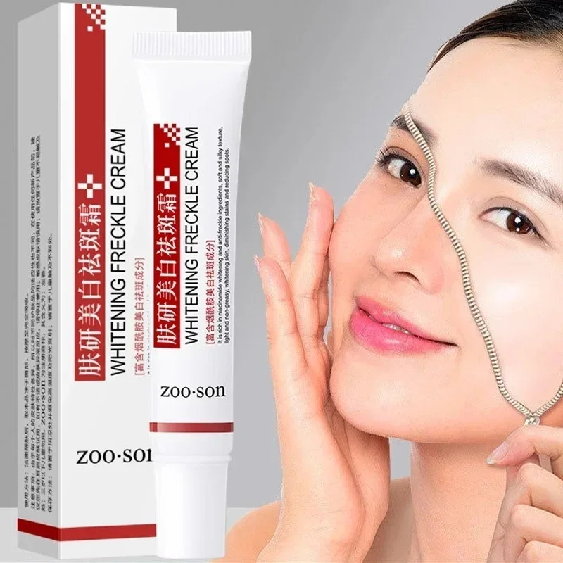 Whitening Freckle Cream Niacinamide Remove Dark Spots Fade Pigmentation Melasma Improve Dullness Fast Brighten Nourish Skin Care