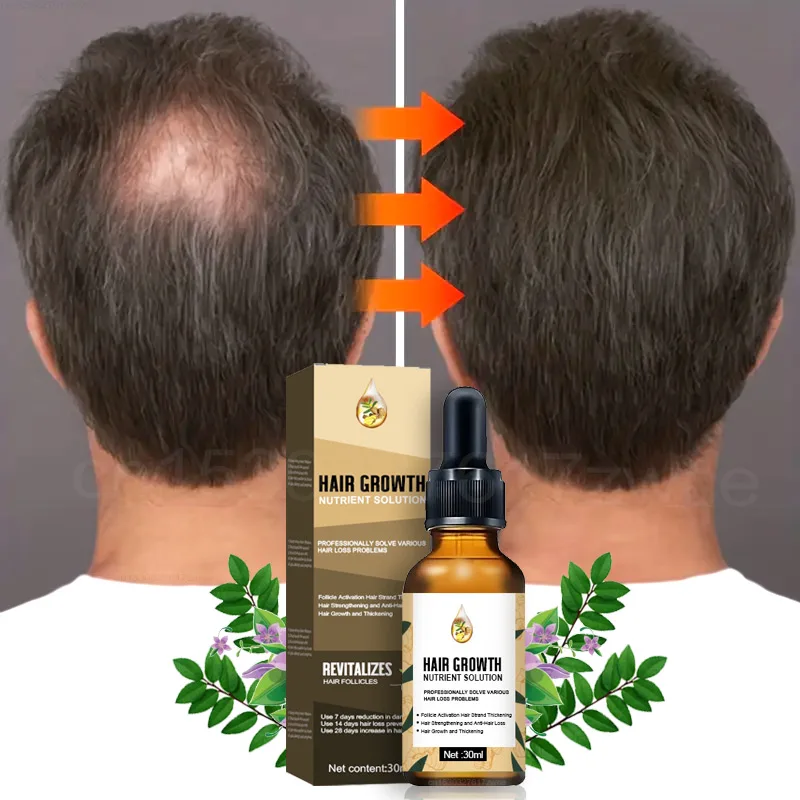 Fast Hair Growth Men Women Ginger Growth Hair Oil Treatment Anti Hair Loss Scalp Treatment Serum Products Beauty Health